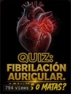 Quiz: Fibrilação Atrial